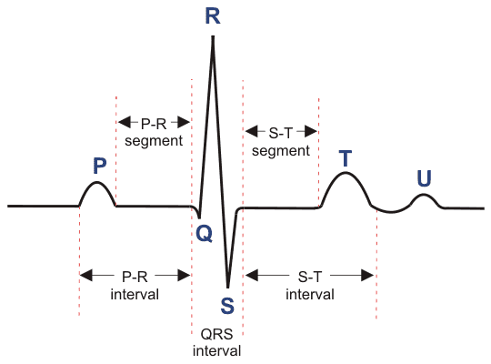 Configuración de grabación de ECG