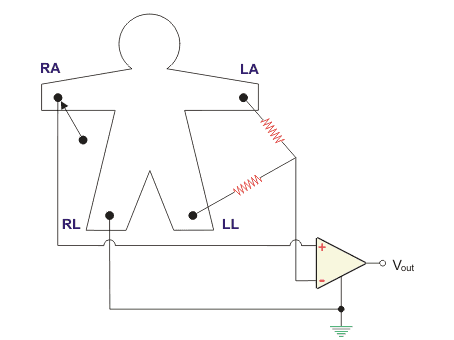 Configuración del sistema de electrocardiograma