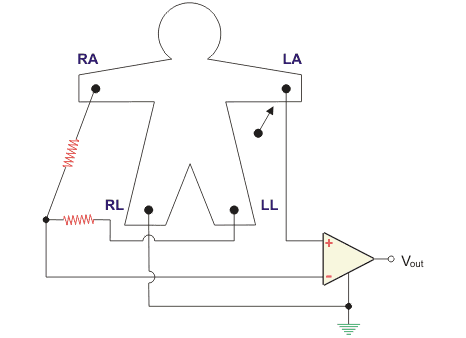 Configuración del sistema de electrocardiograma