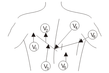 Configuración del sistema de electrocardiograma