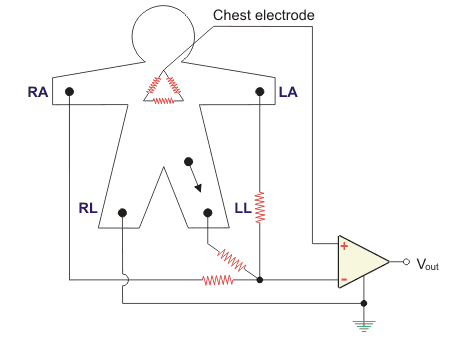 Configuración del sistema de electrocardiograma