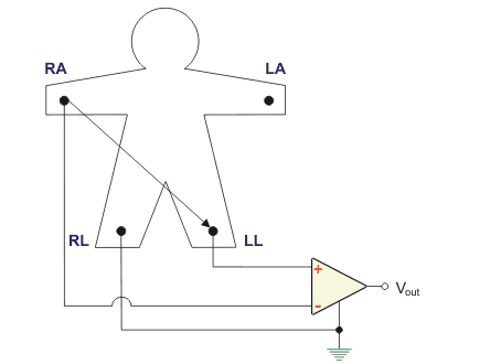 Configuración del sistema de electrocardiograma