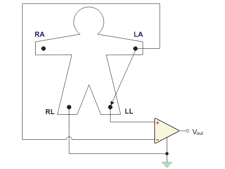 Configuración del sistema de electrocardiograma