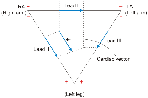 Configuración del sistema de electrocardiograma